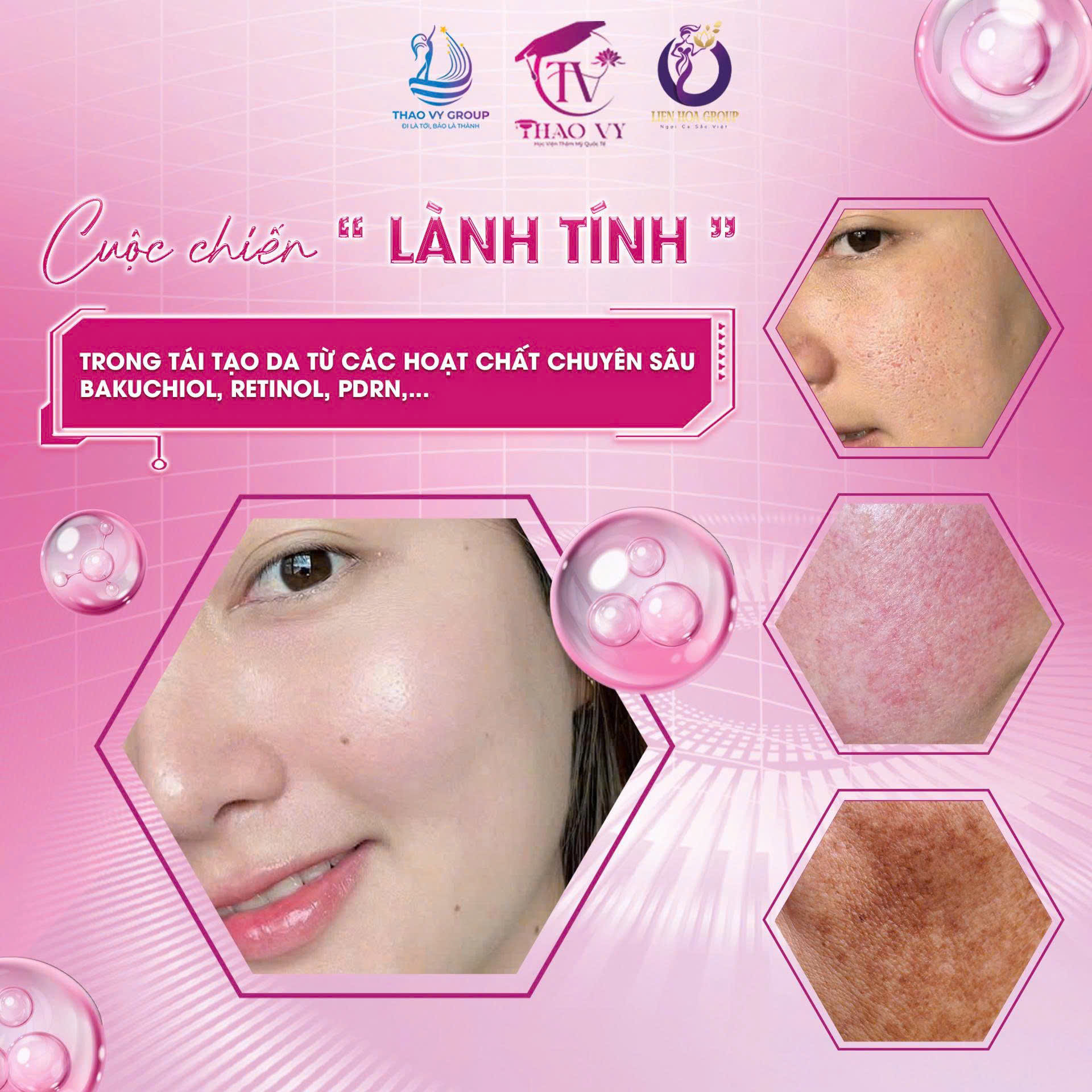 Khóa học chuyên sâu về tái tạo da